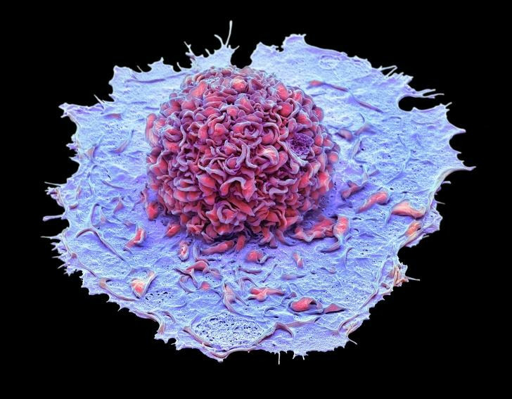 Макрофаг — клетка-пожиратель. Макрофаги захватывают и поедают бактерии, остатки разрушенных клеток и чужеродные организму частицы