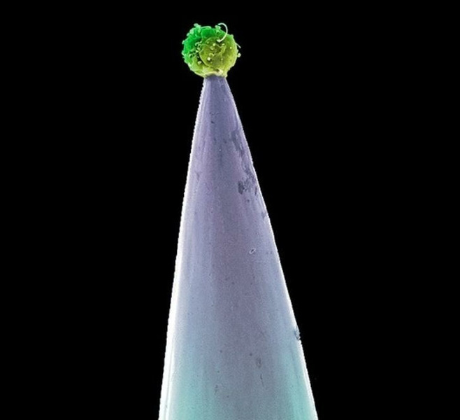 Эмбриональная стволовая клетка на острие иглы. Это единственная клетка в организме человека, которая способна к самообновлению
