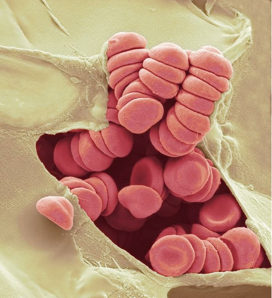 Крошечный порез пальца под электронным микроскопом выглядит так