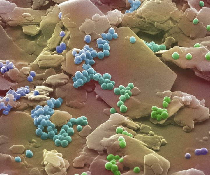 Частицы микропластика, которые остаются на коже после применения косметического скраба