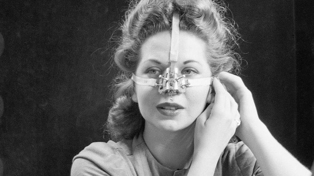Устройство для исправления формы носа, 1930-е