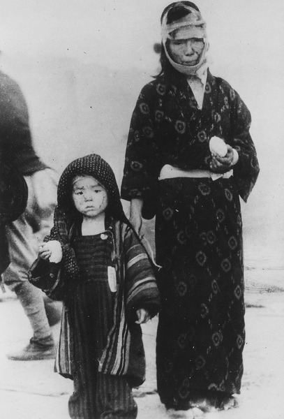 Японская женщина и ее сын, пережившие атомную бомбардировку Нагасаки. Фотография сделана на следующий день после бомбардировки юго-западнее центра взрыва на расстоянии 1 мили от него. В руках женщина и сын держат рис. 10.08.1945 г.