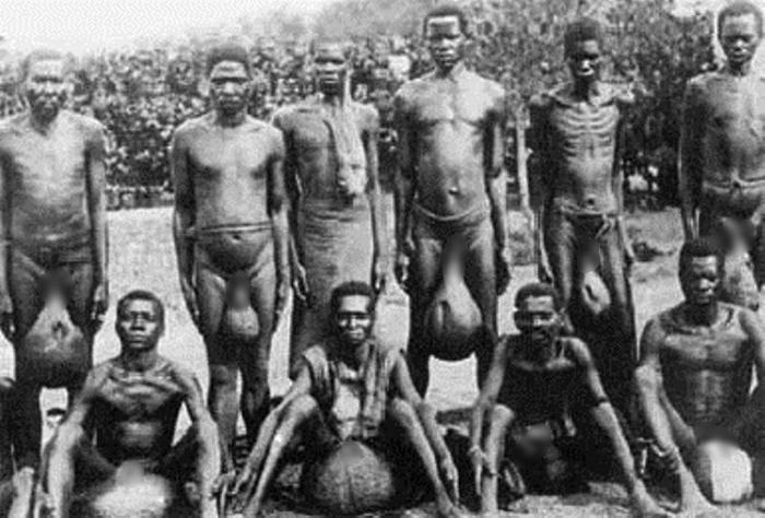 Огромные гениталии мужчин племени бубал